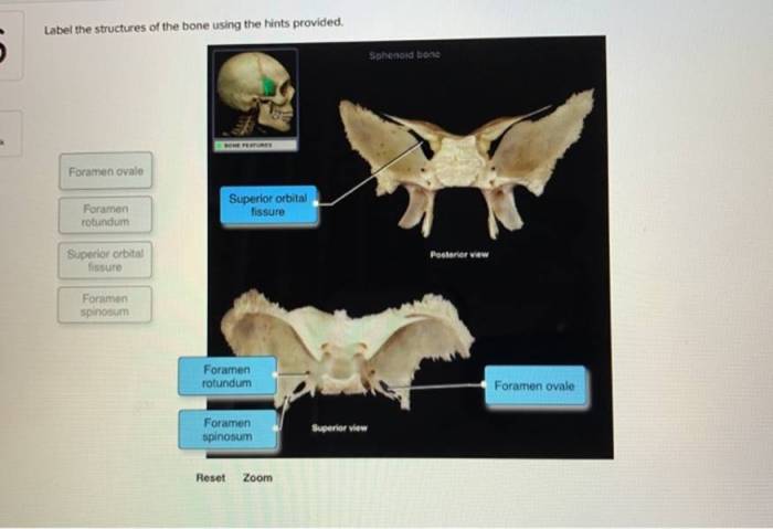 Label the structures of the bone using the hints provided